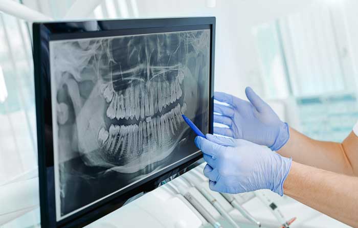 Preventative Dentistry Dental Xrays